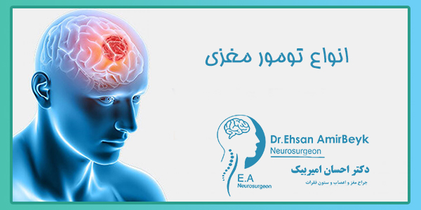 تومورهای مغزی: تفاوت‌ها و روش‌های درمان