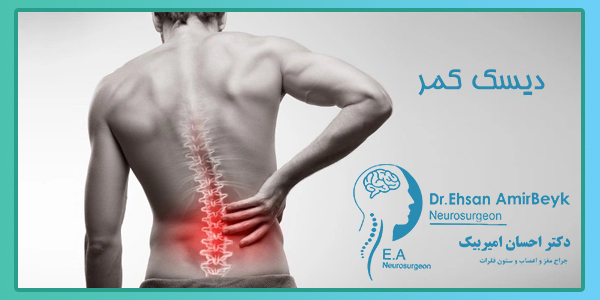 علایم دیسک کمر چیست؟