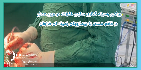 جراحی وسیله گذاری ستون فقرات